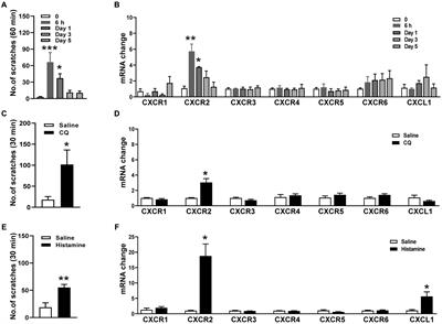Chemokine receptor CXCR2 in primary sensory neurons of trigeminal ganglion mediates orofacial itch